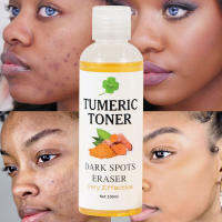 Dark Spots Eraser Turmeric Toner โลชั่นปรับสภาพผิว โทนเนอร์ขมิ้นดำ