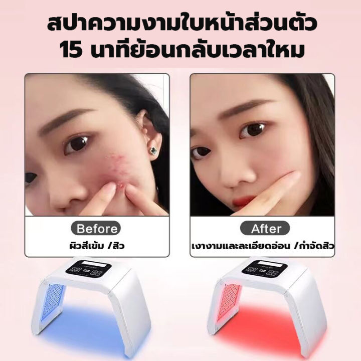 pdt-ไฟสว่างสวย-led-โฟโตไดนามิกแลมป์รักษาสิว-เครื่องฟื้นฟูผิว-pdt-led-light-beauty-photodynamic-lamp-acne-treatment-skin-rejuvenation-machine-ไฟเจ็ดสี-เครื่องโฟตอน-เครื่องฉายแสงรักษาสิว-เครื่องนวดหน้า