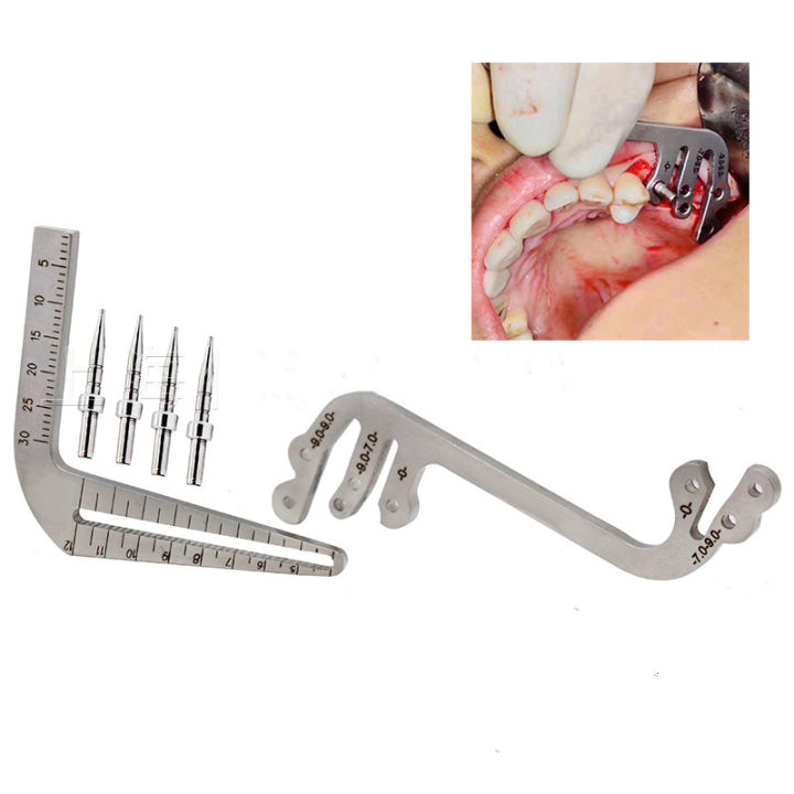 bone-ridge-mapping-caliper-forcep-เครื่องมือวัดรากฟันเทียม