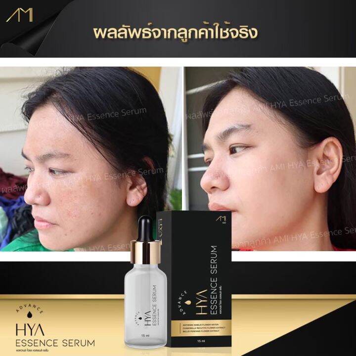 ami-hya-essence-serum-ปริมาณ-15ml-1-ขวด-390-ส่งฟรี-1แถม1