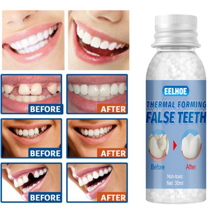 Moon Riverr Thermal Beads Teeth Veneer Moldable Denture Temporary Tooth