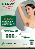 [E-Voucher] เลเซอร์กำจัดขนใต้วงแขน ด้วยเครื่อง FOTONA 4D Removal Program