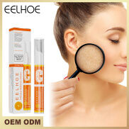 CRUITRSHOP serum Chỉnh Da Trị Mụn Ba Tác Động