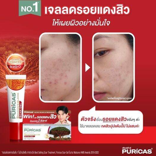 puricas-dragons-blood-scar-gel-8g-เป็นเจลลดรอยสิว