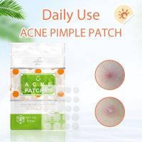 【CW】 2022 Acne Pimple Patch Stickers Acne Cure Pimple Remover Tool Blemish Spot Facial Mask Skin Care Face Skin Care Tools