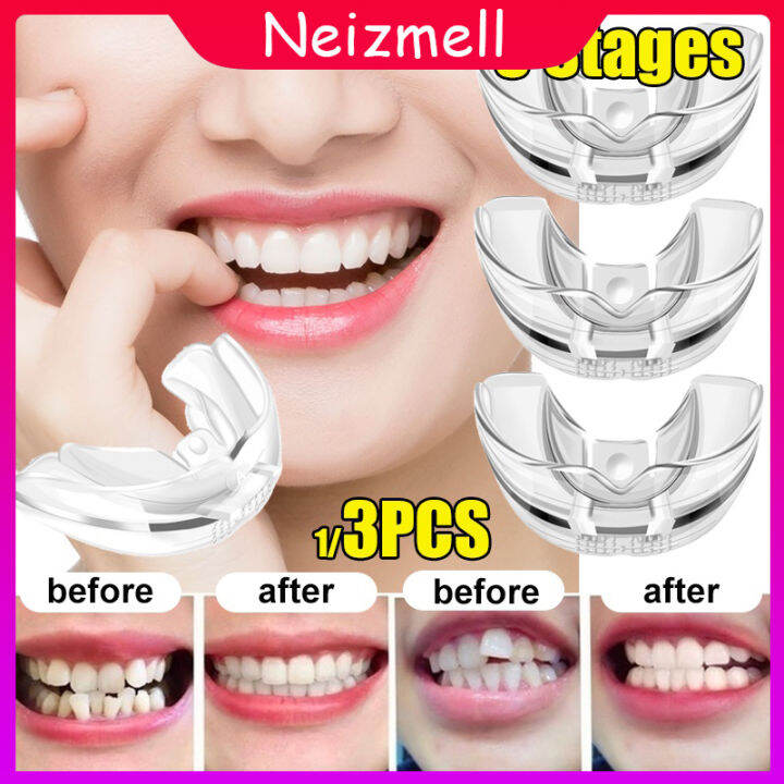 Neizmell 1 Set Phase 13 4D Invisible Teeth Orthodontic Aligner
