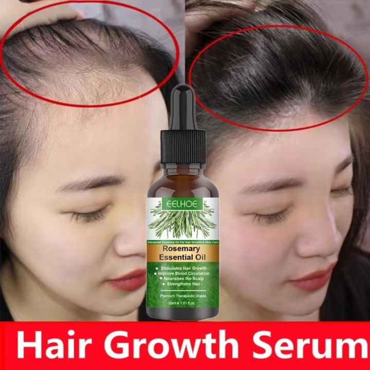 Authentic Rosemary Hair Growth Essential Oil Anti Hair Loss Fast Regrowth Essence Aromatherapy 6392