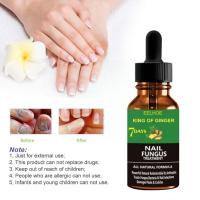 50ml Ginger Foot Antifungal Nail Essence Nails Care Treatment Fungal Anti-fungus Liquid Repair Nail Removal Onychomycosis Oil