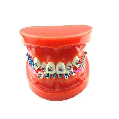 Orthodontic Dental Teeth Model With Brackets Chain Ties Arch Wire Dental Teaching Model