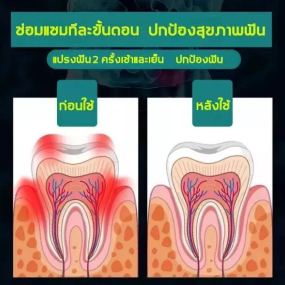 ลดฟันเหลือง-ป้องกันฟันผุ-ยาสีฟันน้ำผึ้งธรรมชาติ-bangchiling-ลดหินปูน-คราบฟัน-ปวดฟัน-มูสฟอกฟันขาว-ยาสีฟันน้ำผึ้ง-ยาสีฟันฟอกขา-ยาสีฟัน-ยาสีฟันขจัดปูน-ฟันผุ-ยาสีฟันฟันขาว-ปวดฟันผุ-ฟันขาว-น้ำยาขัดฟันขาว-ย