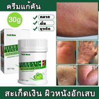 South Moon พืชทรีทรี ยุงกัดสะเก็ดเงิน กลากเกลื้อน เพิ่มความชุ่มชื้น ผิวแห้ง 1หลอด 30g