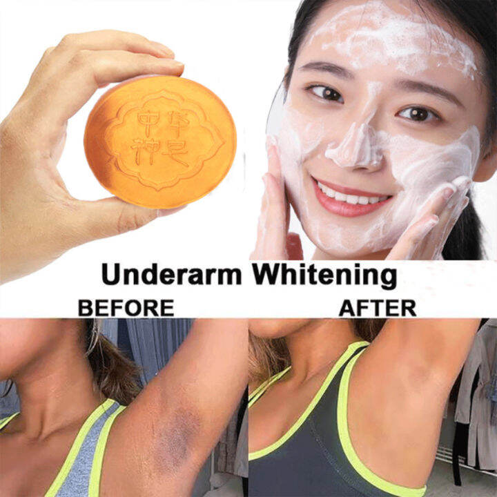 Deep Clean Skin Body Whitening Soap Chicken Skin Removal Soap for