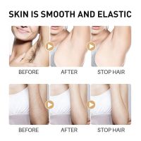 ZZOOI Permanent Hair Removal Spray Natural Painless Armpit Leg Arm Hair Inhibitor Nourishing Brighten Repair Body Care Products 100ml