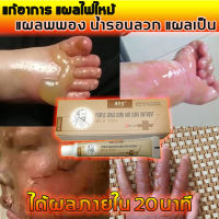 KANGMINTANG ครีมเผาไหม้Scar cream  รอยไหม้ แผลพุพอง รอยไหม้ แผลเป็น  ครีมทาแผลไฟไหม้ ครีมทาแผลเป็นน้ำร้อนลวก ครีมทาแผลไฟไหม้ ครีมกำจัดรอยแผลเป็น เจลทารอยแผลเป็น ลดเลือนรอยแผลไฟไ ครีมลดรอยสิว ครีมทาน้ำร้อนลวก