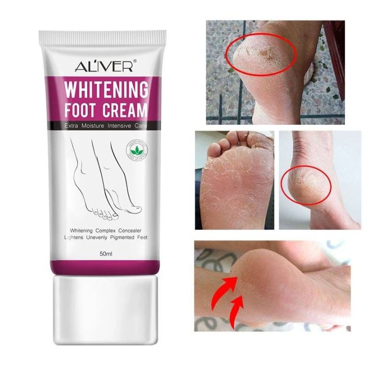 get-now-ของแท้-แน่นอน-ส่งเร็ว-สินค้าขายดี-whitening-extra-moisturizing-treatment-foot-cream-hydrating-smooth-delicate-foot-skin-care