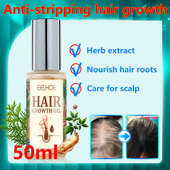 ⚡THICKER HAIR IN 7 DAYS⚡hair grower for men original 50ml/Spray hair growth ⚡THICKER HAIR IN 7 DAYS⚡hair grower for men original 50ml/Spray hair growth