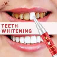 [HCM]Bút Tẩy Trắng Răng Khử Mùi Hôi Miệng Làm Sạch Răng Tẩy Vết Ố Răng Teeth Treatment Whitening Meiyanqiong 5Ml thumbnail