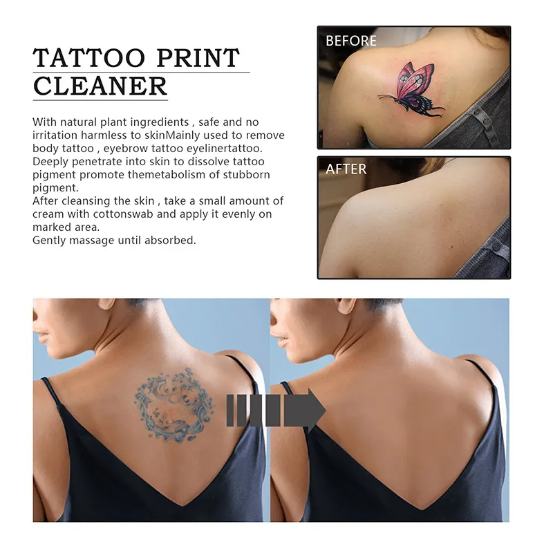 New Tattoo Removal Cream - The Next Cold Fusion?