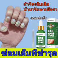 ยาเชื้อราเล็บ เชื้อราที่เล็บ 30ml ยารักษาเล็บ ครีมบำรุงเล็บ ยารักษาเชื้อราที่เล็บ เซรั่มซ่อมแซมเล็บ สูตรสมุนไพรอ่อนๆ ไม่ระคายเคือง เหมาะกับทุกปัญหาเล็บ ส่งเสริมการเจริญเติบโตของเล็บ ยับยั้งแบคทีเรีย 99%/ยาทาแก้เชื้อราที่เล็บ ยารักษาเชื้อราเล็บ เชื้อราเล็บ