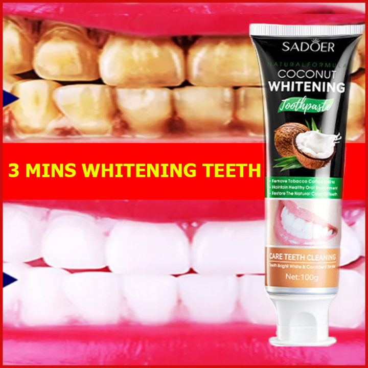 [ FLASH SALE ] 🦷7-day whitening🦷Toothpaste whitening teeth, Activated ...