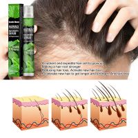 【cw】 Herbal Fast Hair Growth Serums Spray For Men Anti Hair Loss Regrowth Essence Oil Hair Care Products Capillary growth Sprays