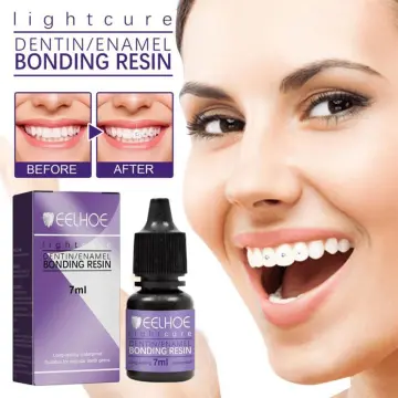 5ml Tooth Gem Bonding Light Cure Adhesive 
