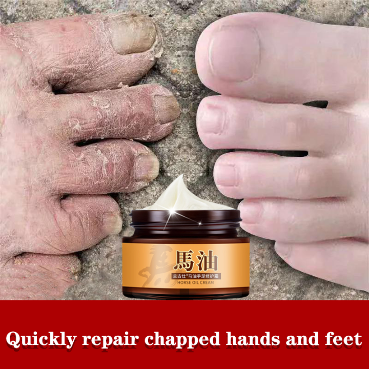 Dry heel repair cream Anticrack Cracked hand and foot cream Heels