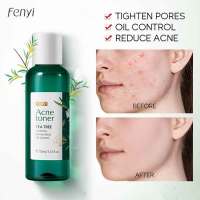 โทนเนอร์สิว FENYI Acne Toner Tea Tree ของแท้?