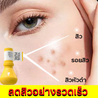 เซรั่มลดสิว  ครีมลดสิว  ครีม ครีมจางรอยสิว 50ml ลดสิว รอยสิว รอยสิวจางลง  อย่างอ่อนโยน  ไม่ระคายเคือง  แก้ปัญหาสิวทุกชนิด