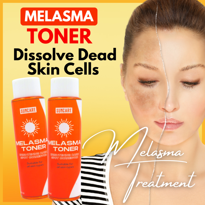 SUNCARE Melasma Toner 100ml Brightening Toner AntiMelasma Toner