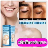 ส่งฟรีปลายทาง 2 ชิ้น ครีมทาผิวด่างขาว ทาได้ทั้งตัวและใบหน้า ให้เรียบเนียน บำรุงผิว 20 กรัม