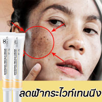 Freckle cream ครีมทาฝ้า 20g ครีมลดฝ้า ไวท์เทนนิ่งครีม ซ่อมแซมผิวหนัง ปรับสีผิวให้กระจ่างใส ลดฝ้ากระที่ฝังลึก