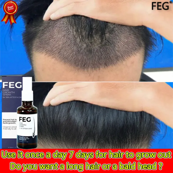 Big Sale】Long hair with just one spray!FEG Hair Growth Spray 50ml Prevent hair loss Big Sale】Long hair with just one spray!FEG Hair Growth Spray 50ml Prevent hair loss