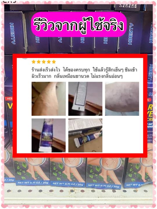 ส่งฟรี-hbesty-ครีมทาเส้นเลือดขอด-ขาสวย-บอกลาเส้นเลือดขอด-ครีมทาเส้นเลือดขอด-ขนาด-20-กรัม