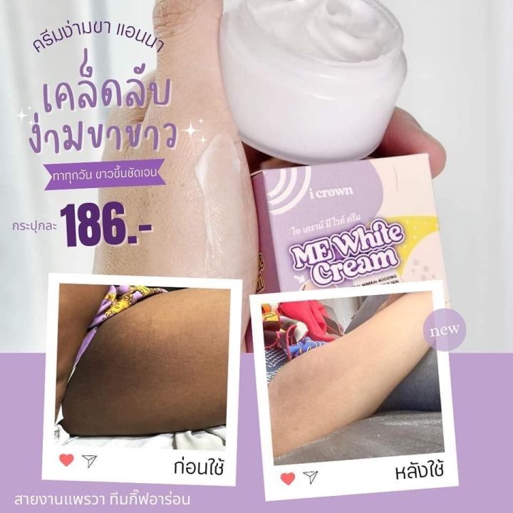 ขายดี-ของแท้-ครีมทาง่ามขาแอนนา-ครีมแอนนา-ไอเคราน์มีไวท์ครีม-crown-me-white-cream-ครีมทาง่ามขาหนีบดำ-ครีมทาในที่ลับ-me-amp-u99