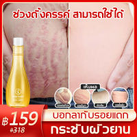 【ได้ผล 100%】XRoland ครีมลดรอยแตกลาย 150ml ทำให้ผิวชุ่มชื้น ซ่อมแซมรอยแตกลาย ลบรอยแตกลายได้อย่างมีประสิทธิภาพ(ครีมทาท้องลาย ครีมท้องแตกลาย ลดผิวแตกลาย ครีมกันแตกลาย ครีมแก้ท้องลาย ครีมทาหลังคลอด ครีมแก้แตกลาย ครีมท้องลาย ครีมทารอยแตกลาย ยาทารอยแตกลาย)