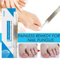 Eelhoe Anti Fungal Nail Cuticle Oil Pen Onychomycosis Paronychia Cuticle Oil Liquid Pen Effective Nails Care For Manicure 3ML