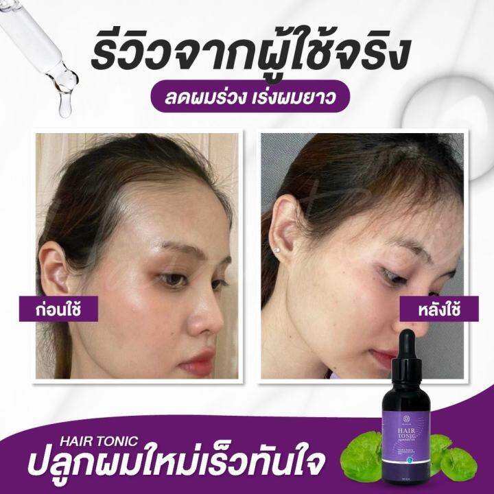 ส่งฟรี-chaba-ชบาโทนิค-ปลูกผม-ป้องกันผมร่วง