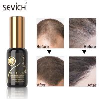 【cw】 Sevich 30Ml Biotin Hair Growth Essential Oil Spray for Men Women Hair Regeneration Repair Treatment Serum Hair Loss Product