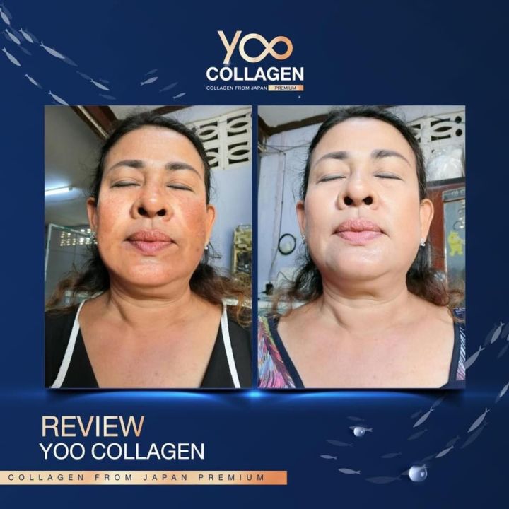 ยู-คอลลาเจน-yoo-collagen-110-กรัม-1-กระปุก-คอลลเจน-ที่-บอยพิษณุ-ยูคอลลาเจน-คอลลเจน-ผิวลื่น-ผิวไม่แห้ง-ไม่มีน้ำตาล-collagen-ขนาด-110-0000มก-พร้อมส่ง