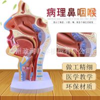 Pathological nasal respiratory throat model medical nasal anatomic model with throat muscle of neurovascular thyroid