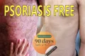 Psoriasis Alternative 90 days Natural Treatment - No drug. No steroid. 