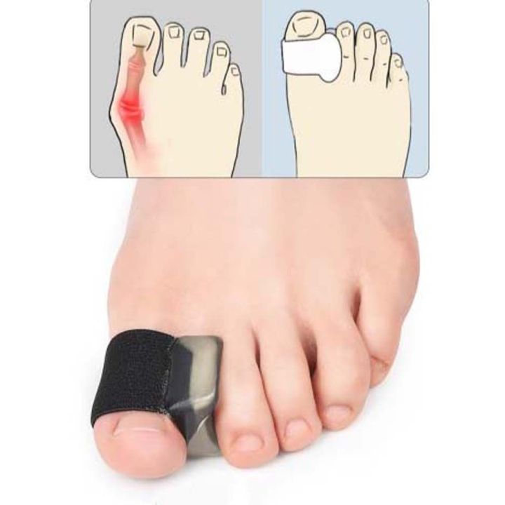rongjingmall-อุปกรณ์พยุงเท้าอุปกรณ์แก้ไขนิ้วโป้งผิดรูปรักษาเท้านิ้วเท้าที่ป้องกันนิ้วเท้าช่วยพยุงกระดูกตัวปรับนิ้วหัวแม่มือนิ้วเท้าอุปกรณ์พยุงกด-thumb-valgus-ปรับซิลิโคนคั่นนิ้วที่คั่นนิ้วเท้าที่ยืดหั