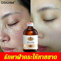 DSIUAN ครีมทาฝ้า 100ml ลดฝ้ากระที่ฝังลึก กำจัดฝ้า  จุดด่างดำ ฝ้า กระ กระจ่างใสผิว  ลดเม็ดสีเมลานิน ครีมทาฝ้าลึก ครีมหน้าขาวใส ครีมทาฝ้ากระ ครีมฝ้ากระ ครีมทาหน้าขาว ครีมกระไวท์เทนนิ่ง ไวท์เทนนิ่งครีม ครีมไวท์เทนนิ่ง บำรุงผิวหน้า ครีมรักษาฝ้า ครีมแก้ฝ้าลึก