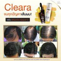 ตัวแทนจำหน่ายอย่างเป็นทางการ✅ ส่งฟรี!! Cleara เซรั่มปลูกผม หนวด คิ้ว บำรุงผมให้แข็งแรง ดกดำ เงางาม 15 มล.