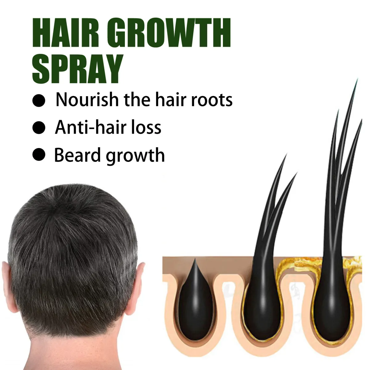 50ml Fast Hair Growth Spray Nourish Hair Roots Prevent Hair Loss Hair Care  Repair Damaged Hair Promote Hair Growth | Lazada