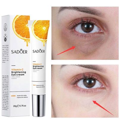 ZWM | Sadoer Vitamin C ว่านหางจระเข้20G ครีมริ้วรอยรอบดวงตาแบ่งเบาเส้นชุ่มชื้นปรับปรุงวงแหวนสีดำครีมลบครีมรอบดวงตาถุงกำจัดขน | ความงาม3ชิ้น