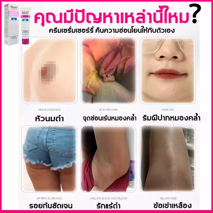 kojic-acid-ครีมขาหนีบดำ-50ml-ครีมทาขาหนีบดำ-ครีมทารักแร้ขาว-ปรับสีผิวให้กระจ่างใส-เลือนเมลานิน-ขาหนีบดำ-ครีมทา-ครีมทาคอดำ-ครีมขาหนีบ-ครีมทาแก้คอดำ-ครีมทาขาหนีบ-ครีมทาจักแร้ดำ-ครีมทาก้นดำ-ครีมผิวขาว