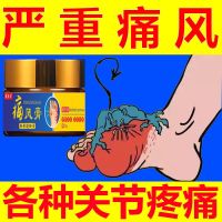 Special Effect Gout Ointment Acid High Pain Stone Crystal Toe Swelling Finger Joint Nemesis And Relief