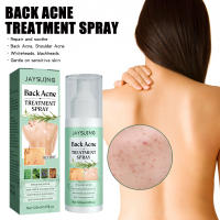 สเปรย์ซ่อมแซมสิวที่หลัง ซ่อมแซมสิวที่หลัง ไหล่ รอยสิวจางลง สเปรย์ดูแลผิว Acne Clear Body Spray สเปรย์ฉีดสิวที่หลัง และลำตัว 120 ml